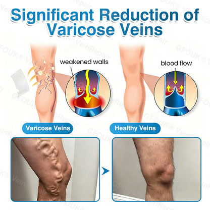 🇨🇦🏆✅️🏃Femscoop® VeinRepair Microneedle Patch Roll⚡Instant Relief, Long-Term Results