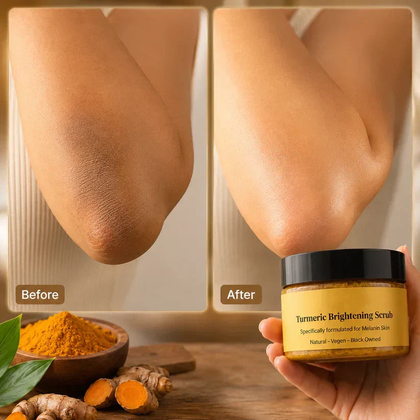 🔥Last Day Buy 1 Get 1 Free ✨Turmeric Exfoliating Body Scrub